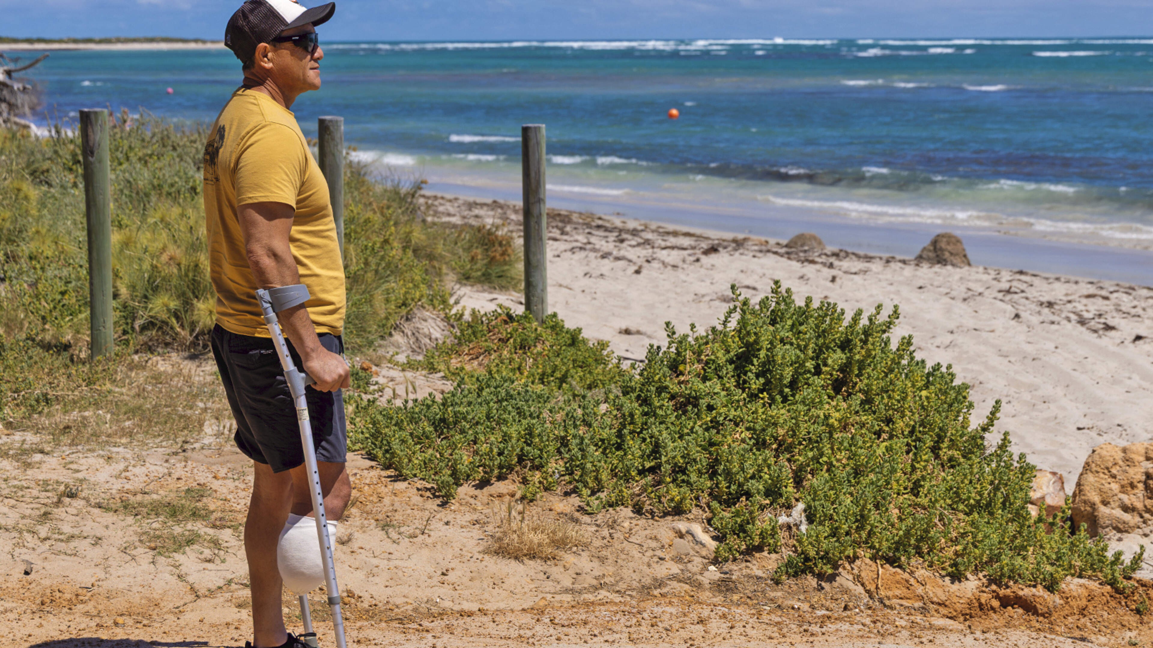 Surfer Who Lost Leg in Shark Attack Tells of 'Winking' Predator and the Community That Saved Him